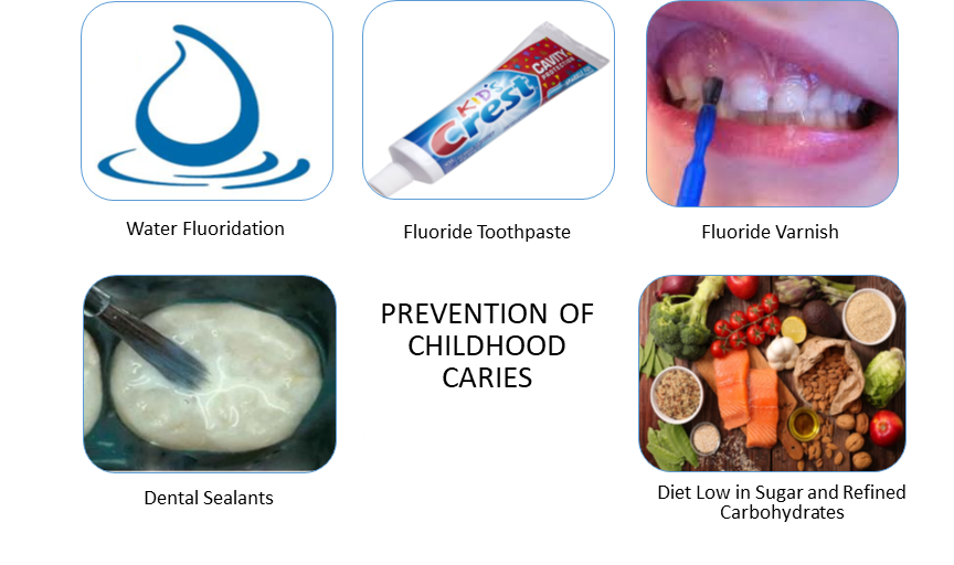 prevention of childhood cavities