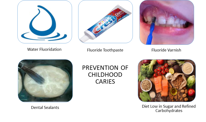 prevention of childhood cavities